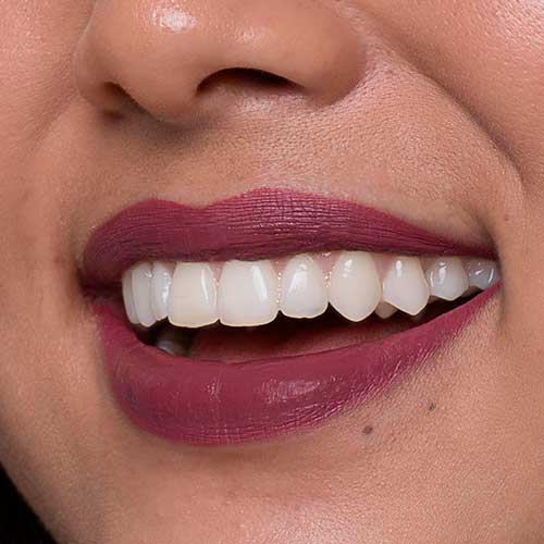 Imagem do produto 25